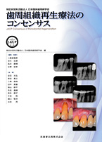 歯周組織再生療法のコンセンサス